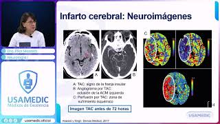 Stroke Ischemic CVA 2025: Stroke Code, Thrombolysis | USAMEDIC
