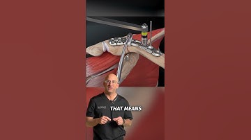 Collare Bone Plate and Screws #shorts