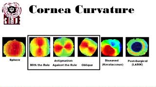 Keratometry and corneal topography