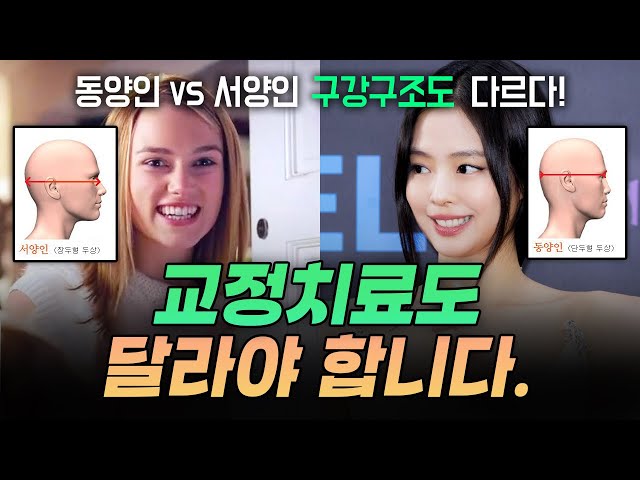 동양인 VS 서양인 구강구조의 큰 차이! 인종별로 추구하는 ‘미’의 기준은?