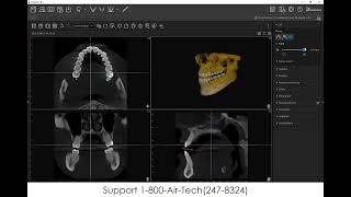 Famous VisionX 3D Tab   MPR Tool Wealth