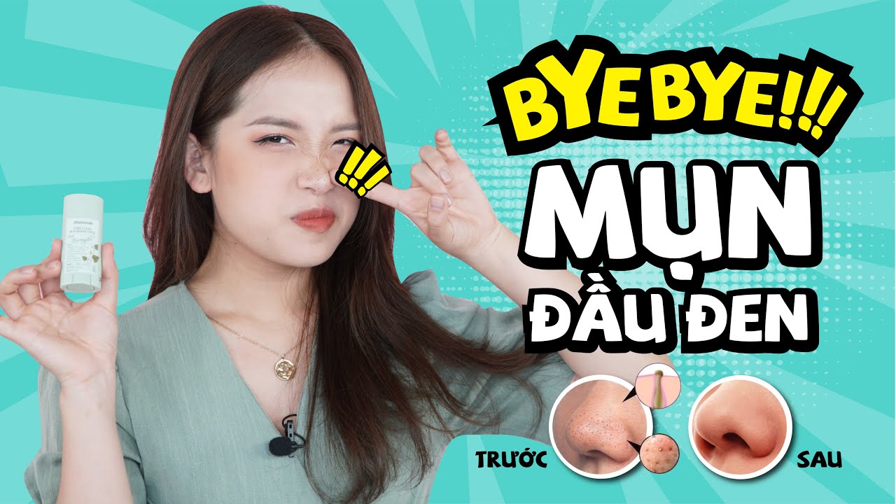 Skincare Routine | MÌNH ĐÃ TRỊ MỤN ĐẦU ĐEN NHƯ THẾ NÀO? | HOW TO TREAT BLACKHEAD ACNE ? |