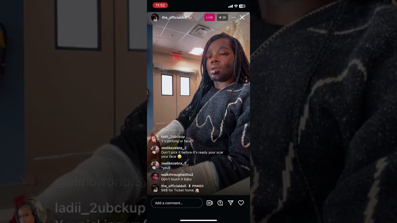 Kenn Scarface No Barbie was evicted out hospital and needs help back to Nashville 😂😂😂