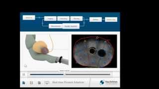 Project Video Real-time Prostate Solutions App screenshot 4