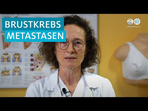 Video: Exosomen Spielen Eine Wichtige Rolle Im Prozess Der Umgekehrten Psoralen-Multidrug-Resistenz Von Brustkrebs