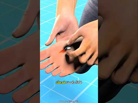 طريقة آمنة لإزالة قطعة الزجاج من قدمك 