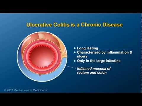 Video: Ulcerøs Colitis: Opbygning Af En Måltidsplan