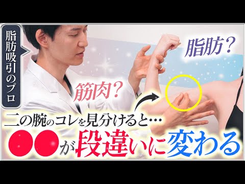 【簡単解説】二の腕脂肪吸引で後悔しないためのポイントとは？脂肪と筋肉の見分け方・セルフチェック方法・部分痩せ効果・腫れや痛みなどのダウンタイム対策まで美容外科医が解説します！
