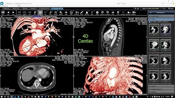4D heart anatomy beating from a multi-phase CT scan