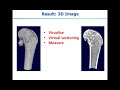 Using Micro-CT Imaging for the Phenotyping and Analysis of Bone Architecture