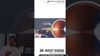 Why Waiting For Cataract To Mature Is A Big Mistake! 🚫