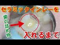 歯の詰め物を入れる前のケアがポイント!! Sharpen Teeth For Ceramic Inlay Installation
