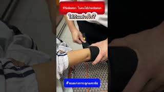 ที่รัดข้อศอก ในคนไข้ปวดข้อศอก ใช้กันอย่างไร? #หมอเก่งกระดูกและข้อ #ปวดข้อศอก #ปวด#ที่รัดข้อศอก