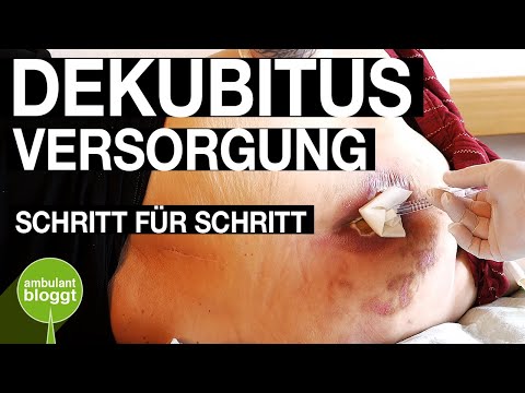 Video: Wie sieht ein Dekubitus im Stadium 2 aus?