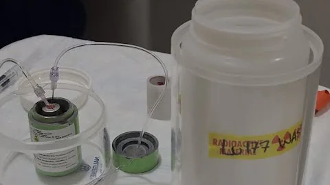 Symptoms and treatment of pancreatic neuroendocrine tumors (PNETs) - Mayo Clinic