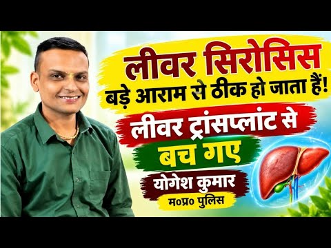 लीवर सिरोसिस बड़े आराम से ठीक हो जाता हैं | लीवर ट्रांसप्लांट से बच गए योगेश कुमार