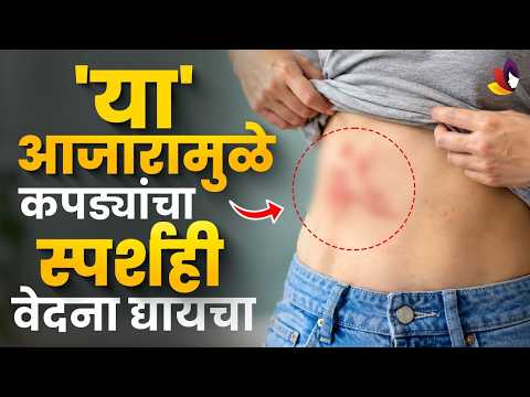 ३ वर्षांनंतरही अंगाचा दाह का संपला नाही? जाणून घ्या डॉक्टरांचा सल्ला |Dr. Priya Rathi | Lokmat Sakhi
