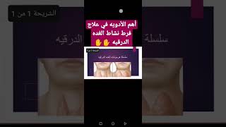 أهم الادويه لعلاج فرط نشاط الغده الدرقيه ??