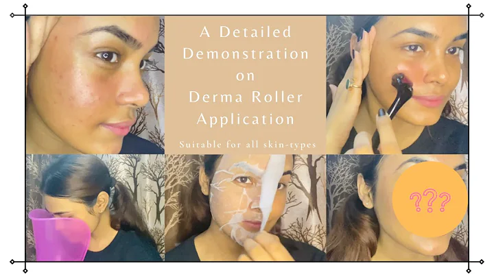 The Magic Of Derma Roller + Hot Water Steam | See ...