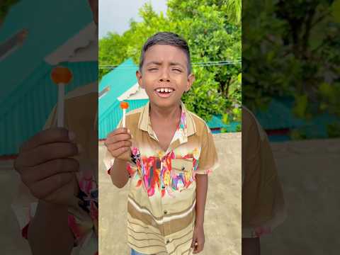 What is wrong with Raju's brother's feet😱 #shorts #trending #viralvideo #youtubeshorts #funny