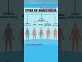 Types of anesthesia#nursing #medicosstuff #bestmedicalcollegeinindia #ytshorts #viral #education
