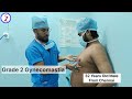 Gynecomastia Surgery In Chennai | Grade 2 Gynecomastia Surgery Chennai | Zenith Clinic.