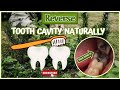 How to Reverse Tooth Cavity Naturally & Prevent Future Cavities