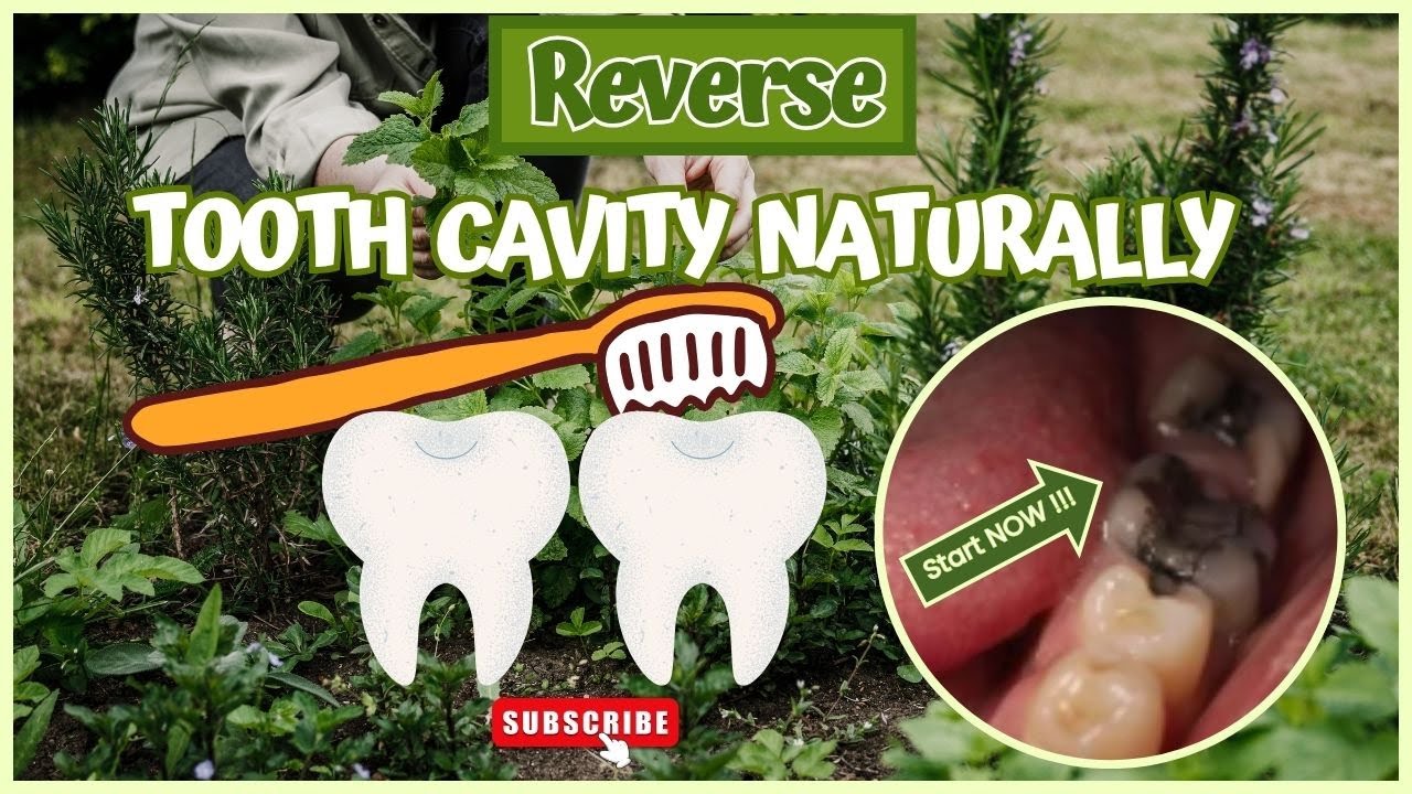 How to Reverse Tooth Cavity Naturally & Prevent Future Cavities - YouTube