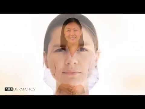 Best Skincare Singapore - MD Dermatics As We Age