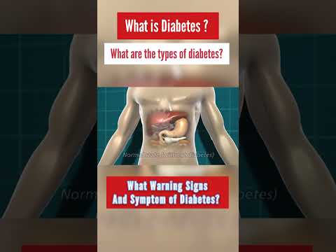 Diabetes insipidus | Diabetes Type 1 and Type 2, Animation. #Shorts #Diabetes #sign