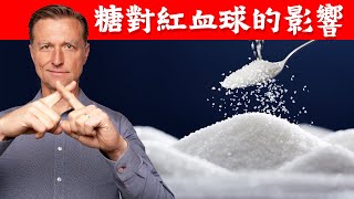 糖對紅血球的破壞,讓你不敢再吃糖!柏格醫生 Dr Berg