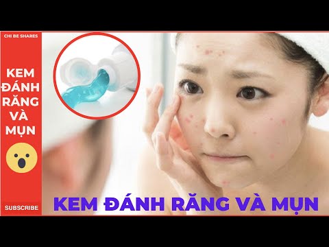 Video Kem đánh răng có trị mụn hiệu quả không? - youtube