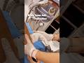 Laser Hair Reduction – Flaunt Smooth, Hair-Free Skin Effortlessly!