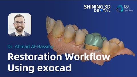 Restoration workflow using exocad