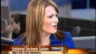 Epidermal Electronic System revolutionary or invasive?