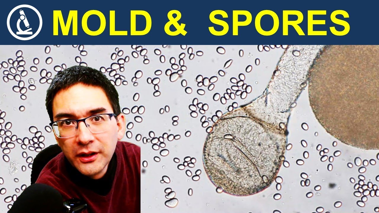 How to observe Mold (Fungus) under the microscope 🔬