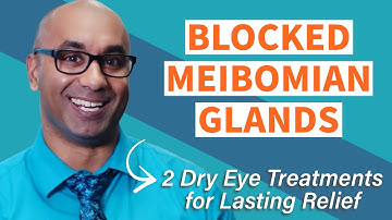 Blocked Meibomian Glands | 2 dry eye treatment tips for lasting relief!