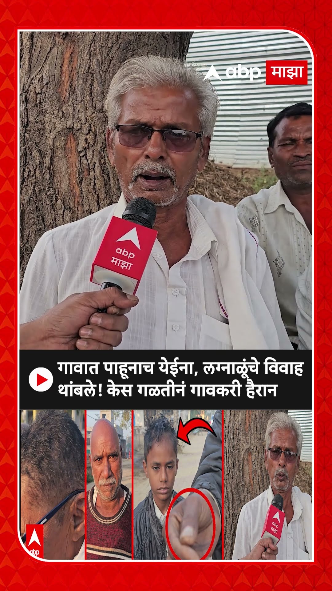 Buldhana Hair Fall : गावात पाहुणाच येईना, लग्नाळूंचे विवाह थांबले! केस गळतीनं गावकरी हैरान