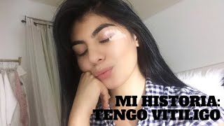 Mi Historia Tengo Vitiligo