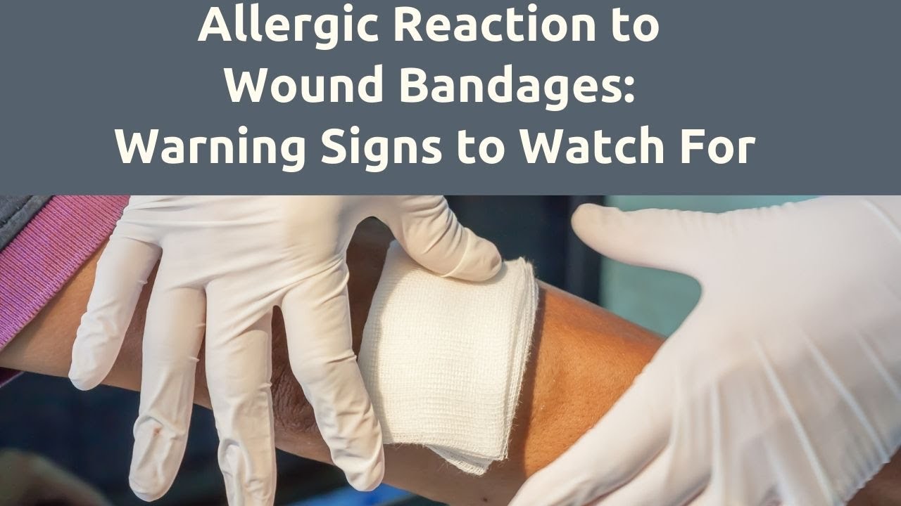Is Your Bandage Making Things Worse? Signs of Allergic Reactions YouTube