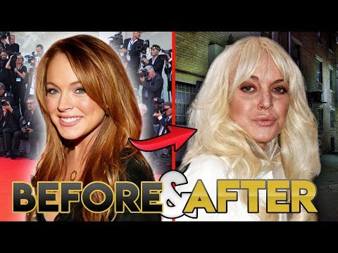 Video: Lindsay Lohan Plastic Surgery: Before And After