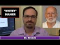 James "Whitey" Bulger | Mental Health & Personality