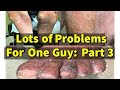 Lots of Problems For One Guy, Part 3: The Heels