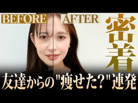 1day小顔®︎ですっきりフェイスラインに！みんなに「痩せた？」と言われるその効果とは？