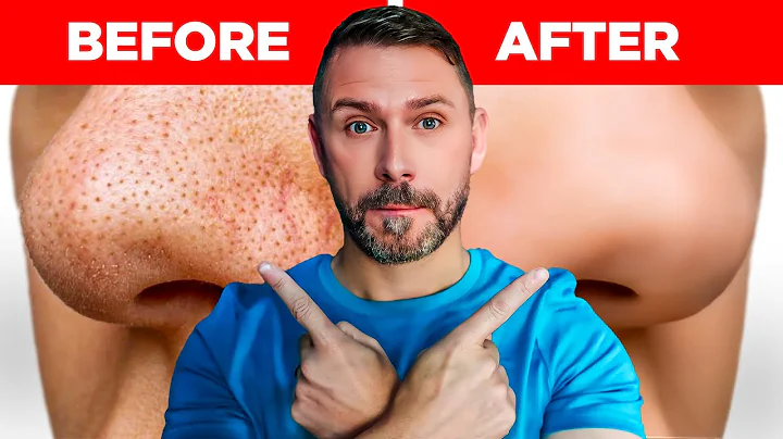 SHRINK LARGE PORES INSTANTLY WITH THIS TRICK!