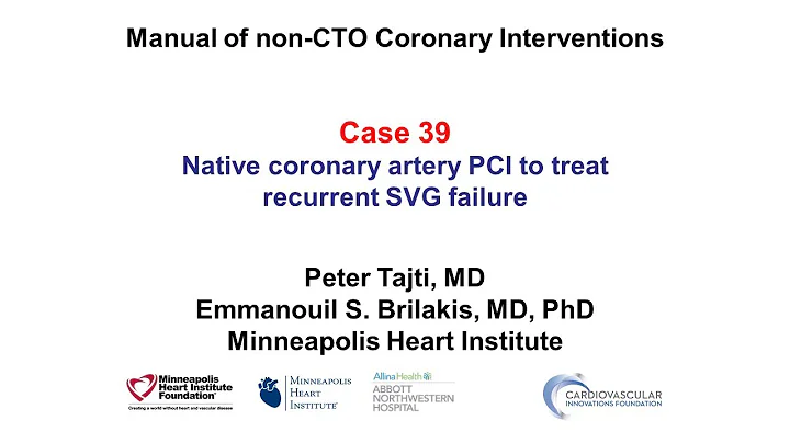 Case 39: PCI Manual - Native instead of SVG PCI