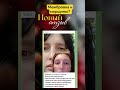 МЕЖБРОВКА И МОРЩИНЫ?