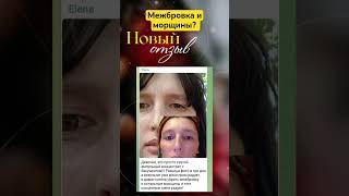 МЕЖБРОВКА И МОРЩИНЫ?