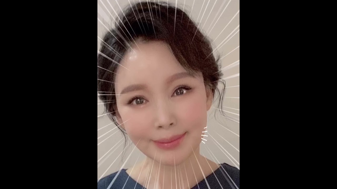 [貝瑞好整形外科診所] #貝瑞好整形外科 臉部拉提 中年整形外科❤️facelite 拉皮手術