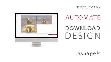(Spanish) 3Shape Automate – Downloading your design